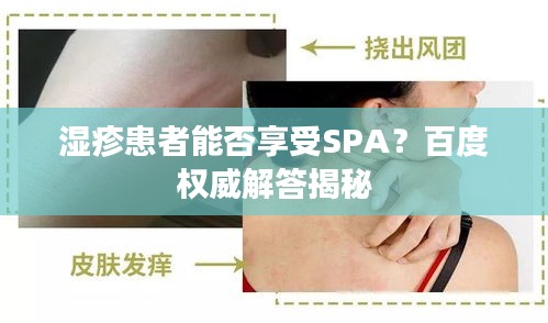 湿疹患者能否享受SPA？百度权威解答揭秘